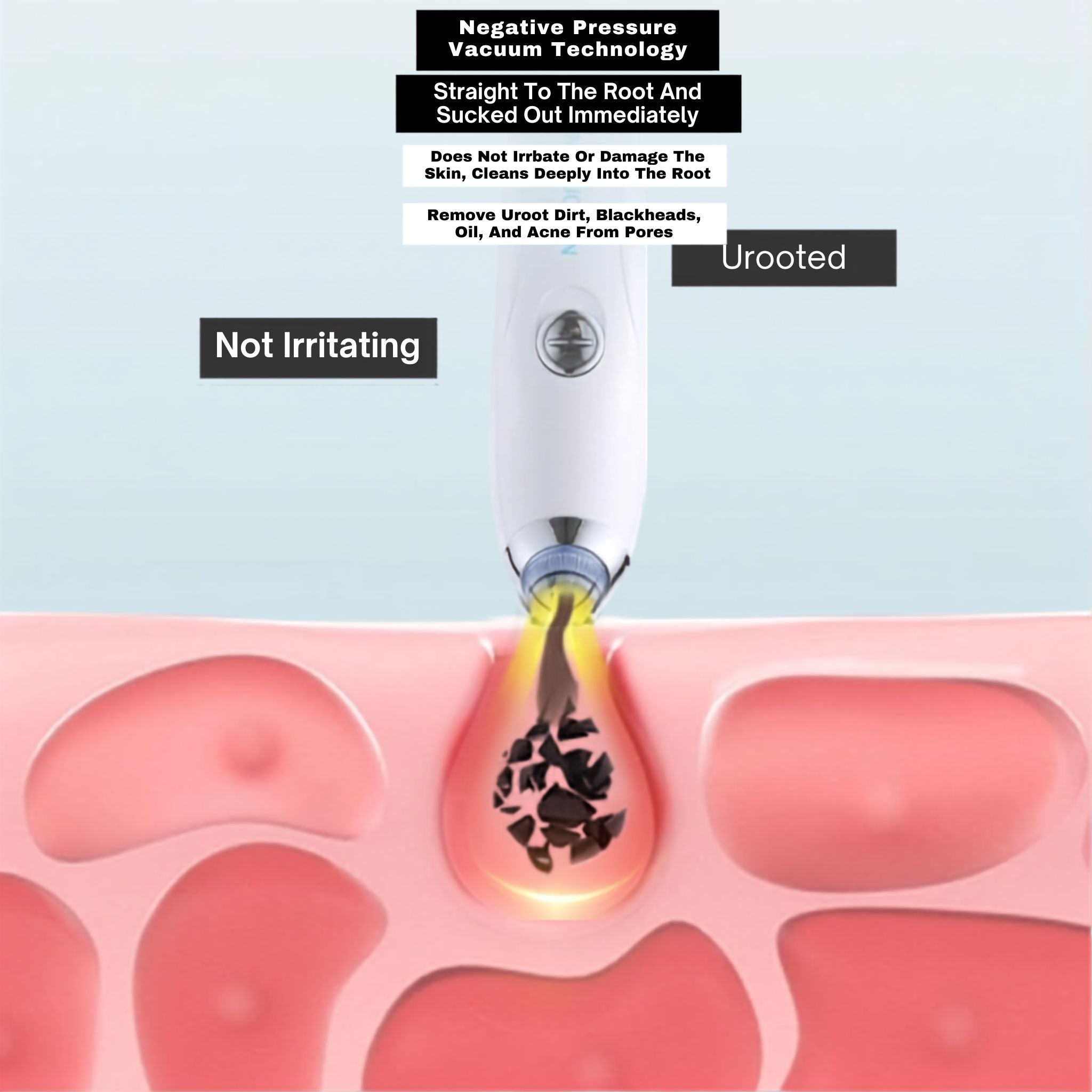 4-in-1 Blackhead Remover Tool