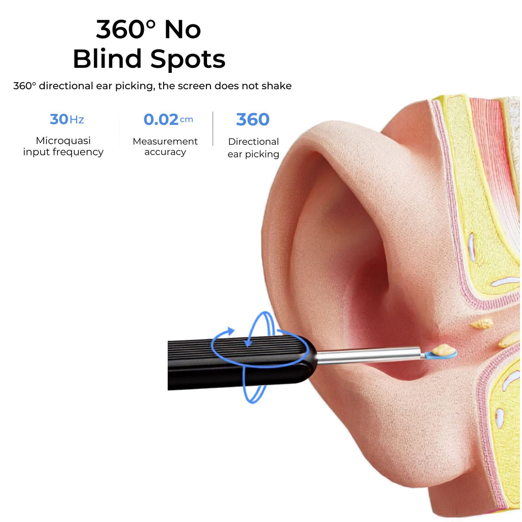 Earocam Earwax Removal Tool Kit with HD Camera Wifi Connection and 6 LED Light